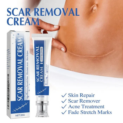 Scar Removal Cream