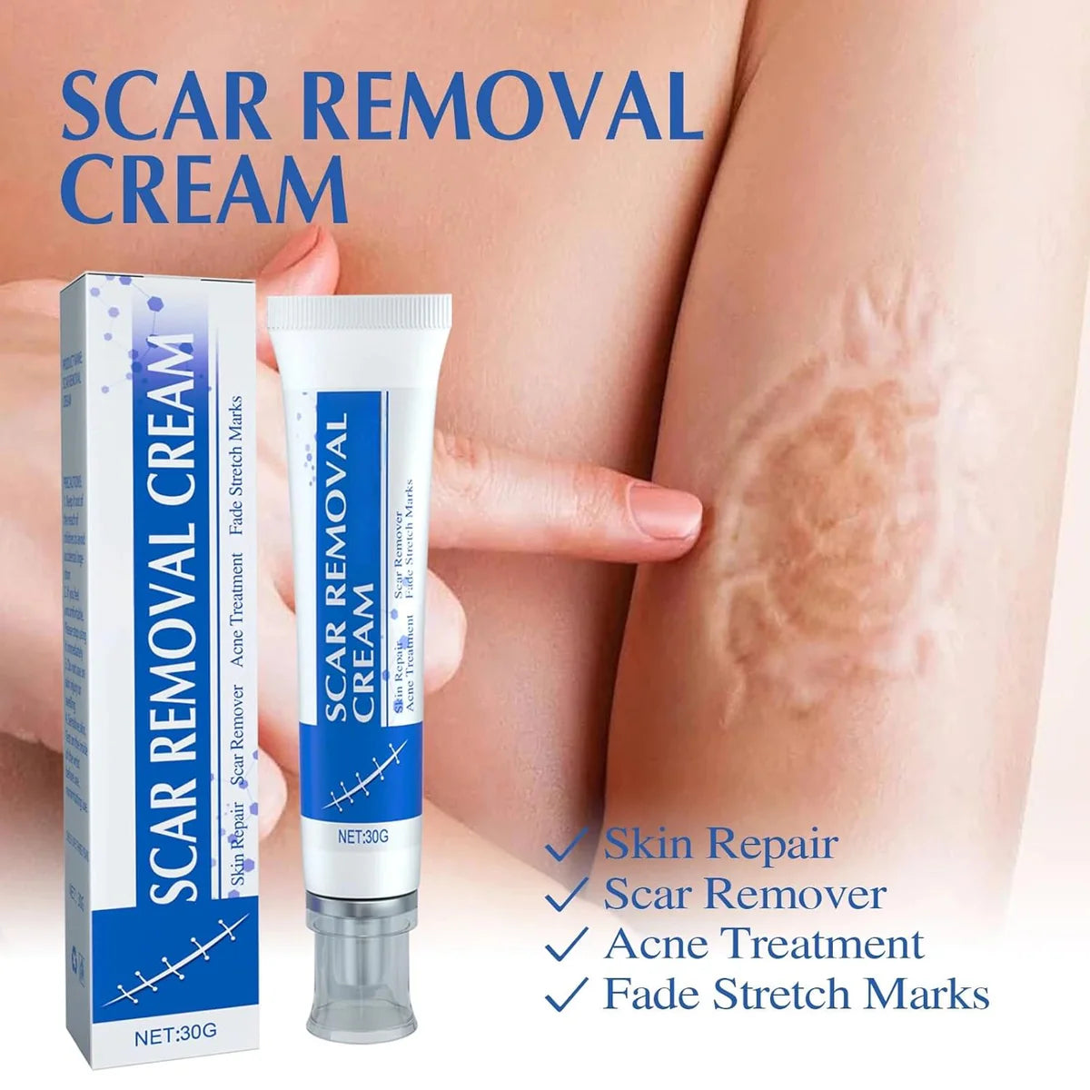 Scar Removal Cream