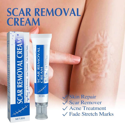 Scar Removal Cream