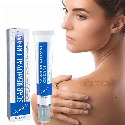 Scar Removal Cream